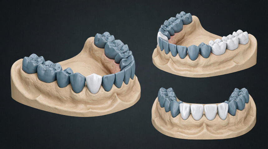 Teeth